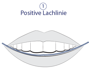Ästhetische Zahnmedizin - Positive Lachlinie