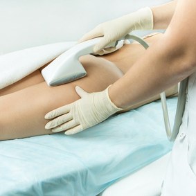 VelaShape gegen Cellulite