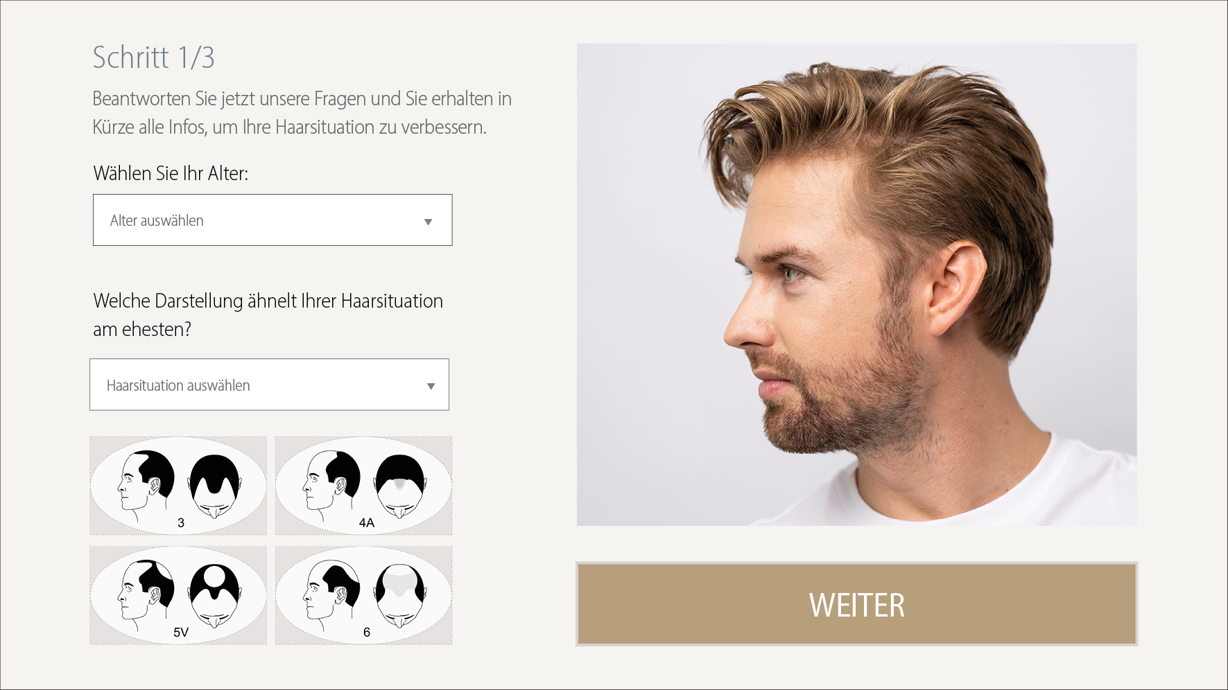 Grafts fest haartransplantation wann die sind Nach Haartransplantation