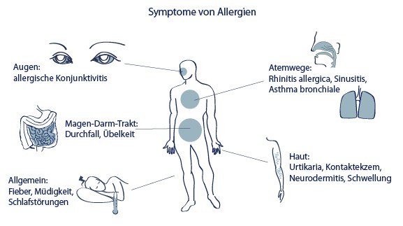 Allergie Symptome