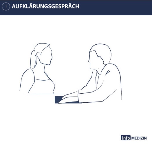 Illustration Darmspiegelung Ablauf Vorgespräch