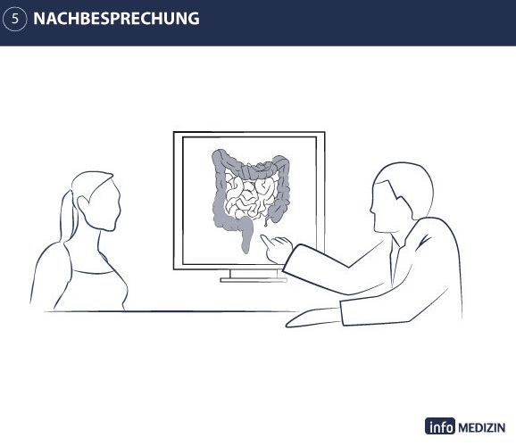 Illustration Darmspiegelung Ablauf Nachbesprechung