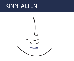 Kinnfalten