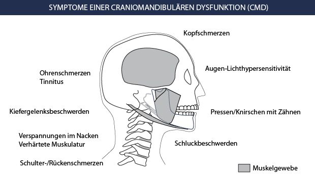 Nach weisheitszahn op kieferknacken Weisheitszahn Op?