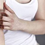 Neurodermitis Behandlung