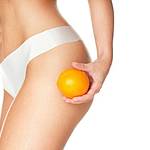 Cellfina gegen Cellulite