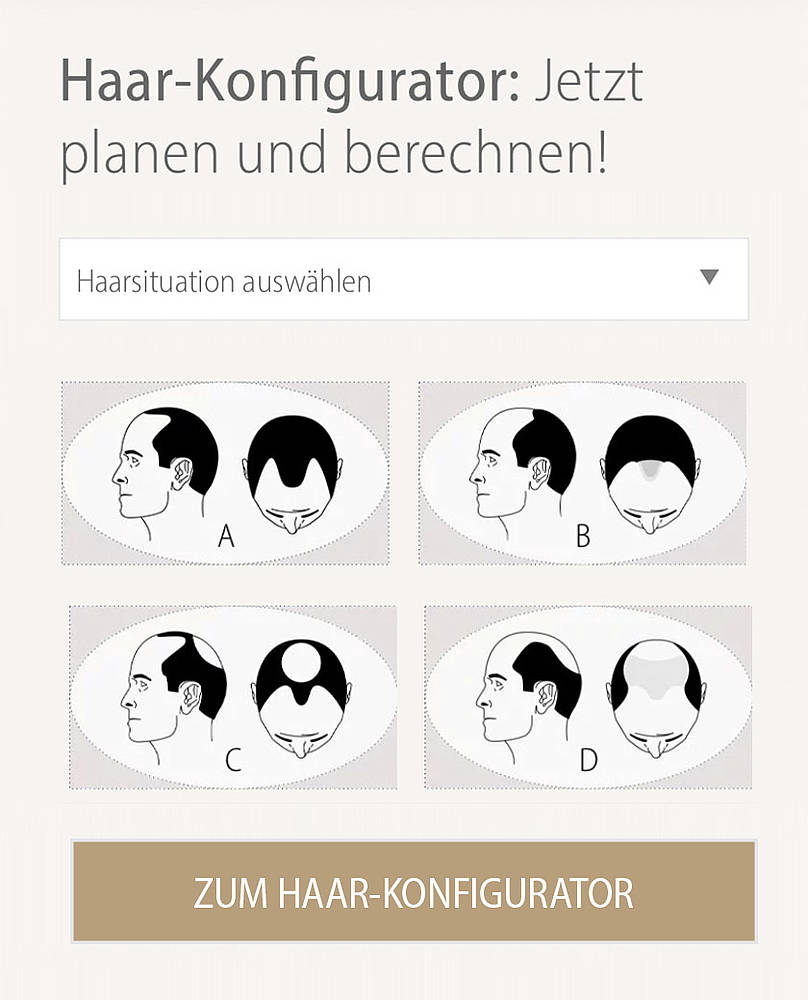 haartransplantation haarkonfigurator info medizin proaesthetic